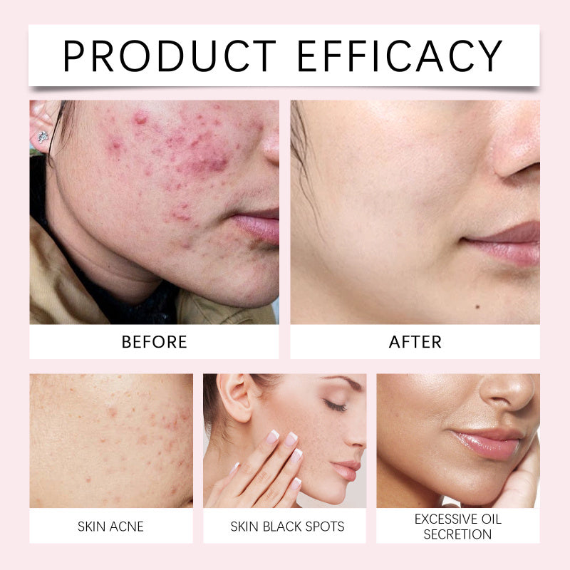 Shiva™ Turmeric Kojic cleansing pads