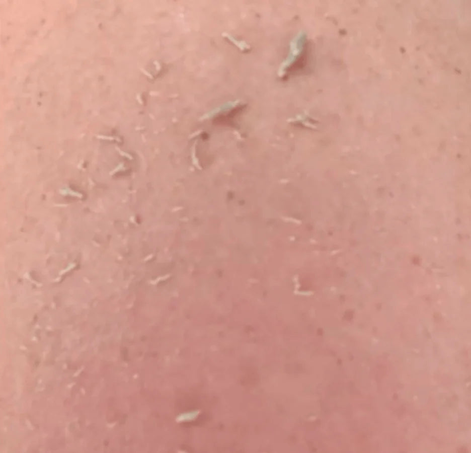 Shiva™ Soft Scrub-Paket